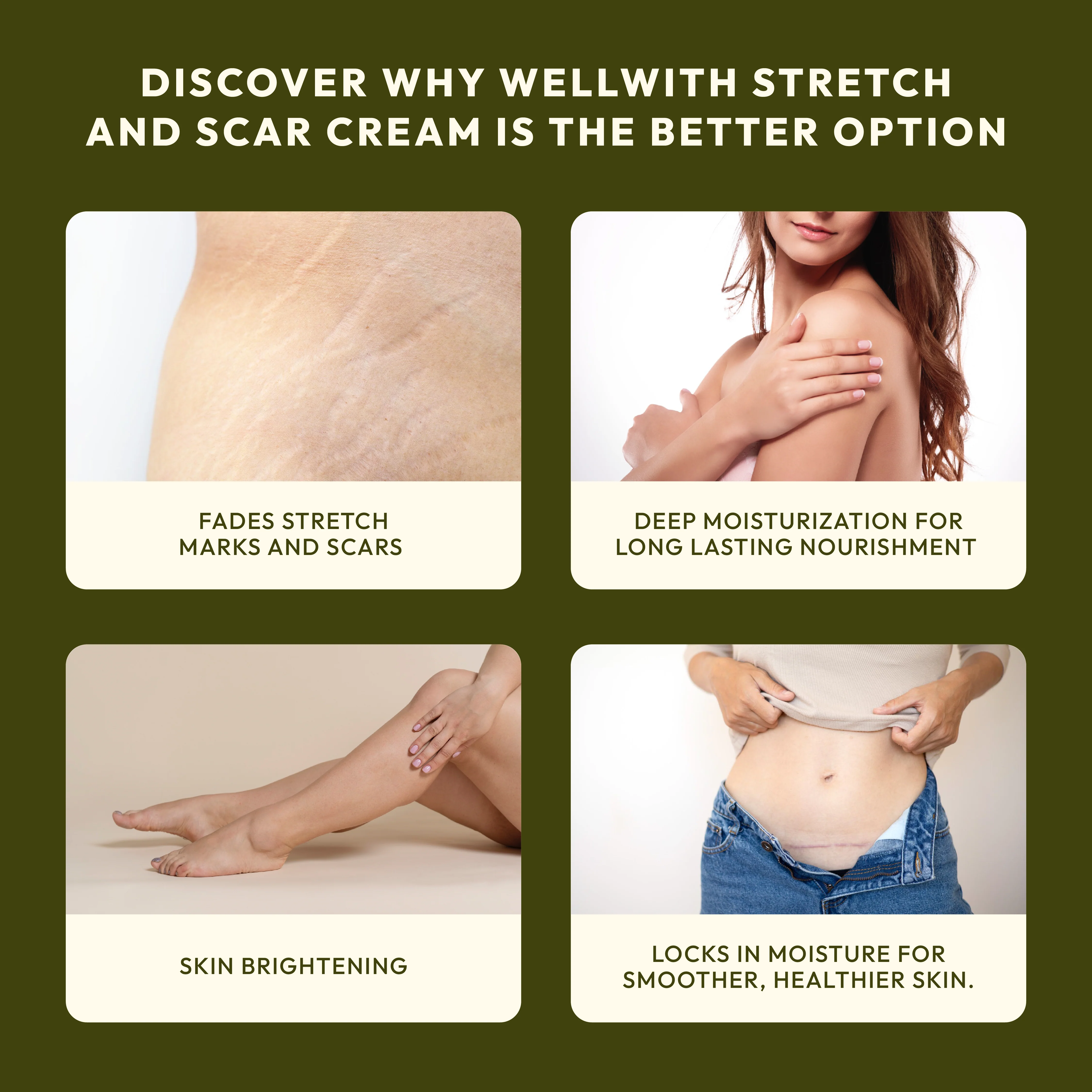 Stretch & Scar Cream 50gm - Image 4